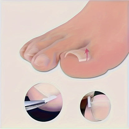 [Ingrown Toenail Kit] Ingrown Toenail Kit - 10/20/30/40/50/60/70/80/90/100pcs of Foot Tools and Foot Tools